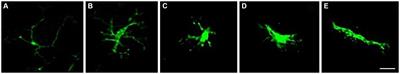 Oligodendrocyte precursor cell-derived exosomes combined with cell therapy promote clinical recovery by immunomodulation and gliosis attenuation